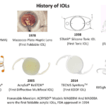Choosing the Right Lens for Your Cataract Surgery: The Complete Guide