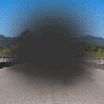 Macular Degeneration: Age-Related Vision Loss Explained