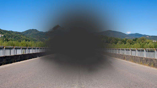 You are currently viewing Macular Degeneration: Age-Related Vision Loss Explained